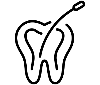 根管治療